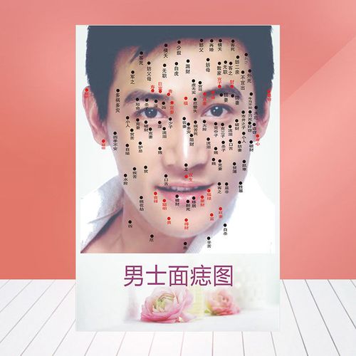 男士脸部点痣海报面痣取痣去痣挂图图片除痣经络穴位图749
