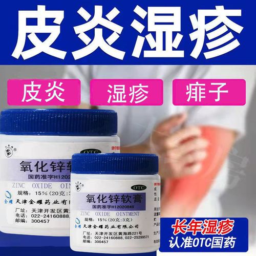 氧化锌软膏治湿疹急性皮炎脂溢性皮炎神经性皮炎痱子止痒湿疹药膏