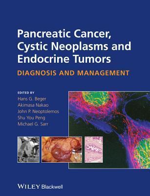 预订 高被引pancreatic cancer, cystic neoplasms and endo