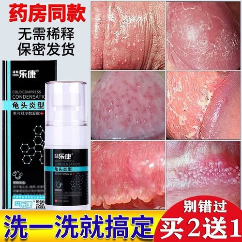 龟头炎包皮阴囊潮湿瘙痒私处康净男士菌液抗冠状沟粒珍珠红点19jy
