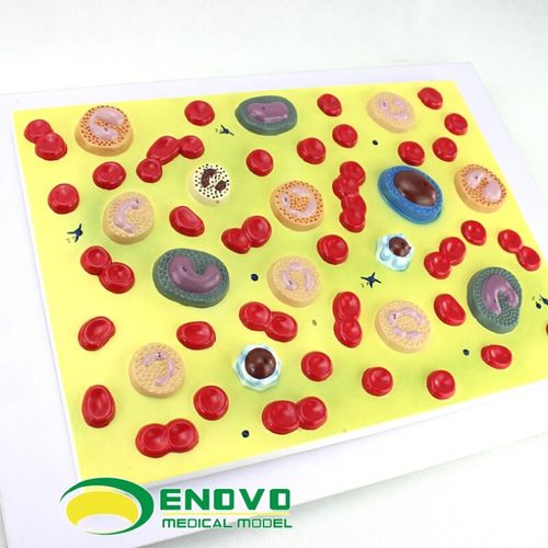 颐诺(enovo medical model)医学人体血细胞放大模型血液病学内科病理