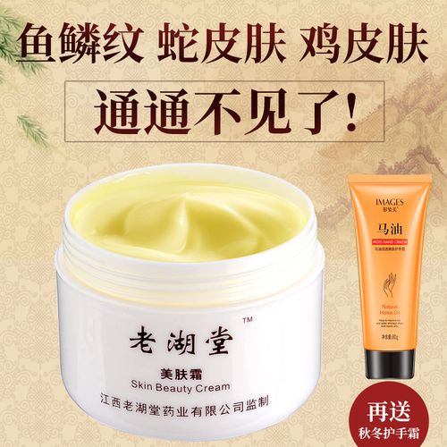 鱼鳞皮肤霜去鸡皮疙瘩毛囊角化角质救星病祛蛇皮腿去除克星身体乳