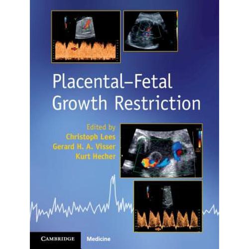 预订 placental-fetal growth restriction [9781107101395]
