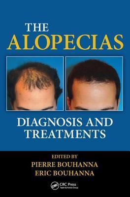 预订 高被引the alopecias