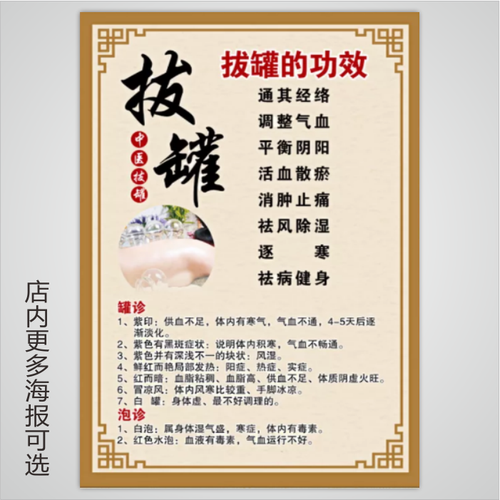 拔罐的功效经络艾灸刮痧人体穴位图挂图中医养生馆图片宣传画海报
