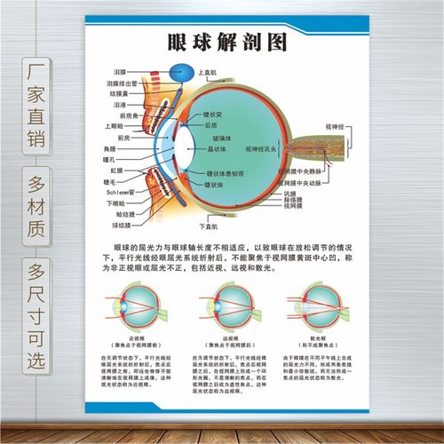 眼睛眼球结构图眼球解剖图剖面图眼科海报挂图q展板