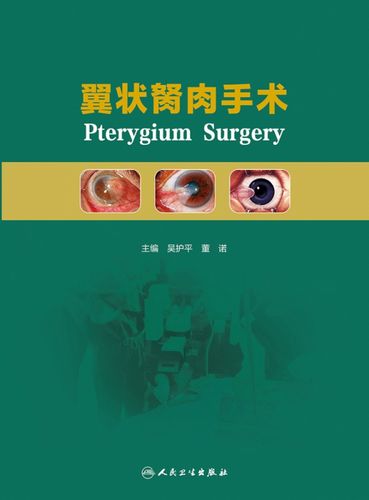 翼状胬肉手术(配增值)
