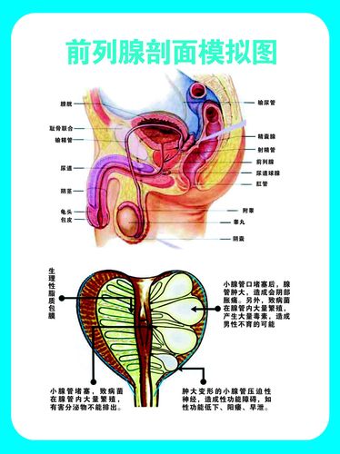 751海报印制展板写真470医院健康知识男科挂图前列腺剖面模拟图