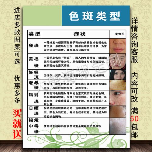 色斑黄褐斑妊娠纹雀 祛斑祛痘皮肤管理海报定制贴画挂图 色斑类型