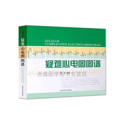 例心电图技师入门常见异常心电图图谱搭明明白白心电图解速成讲授书籍