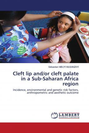 预订 cleft lip and/or cleft palate in a s. [9786203574425]
