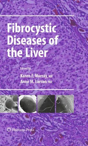 【预订】fibrocystic diseases of the liver