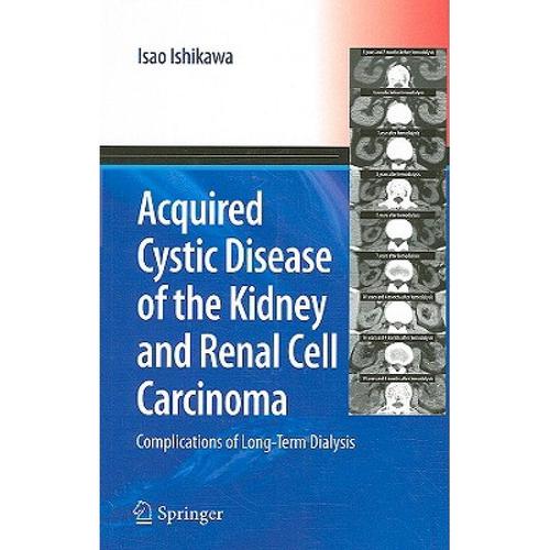 预订 acquired cystic disease of the kidne. [9784431694793]