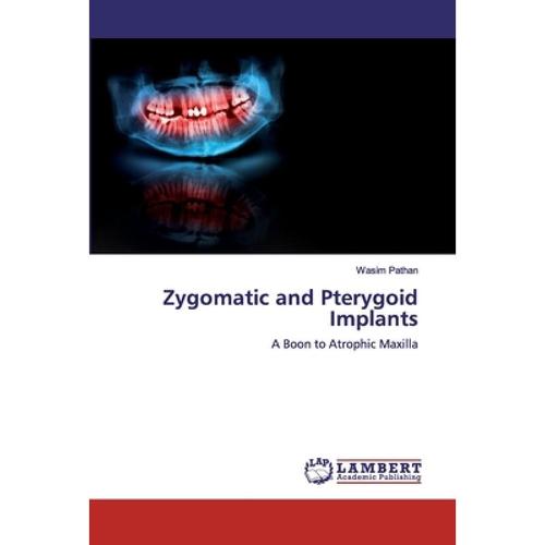 预订 zygomatic and pterygoid implants