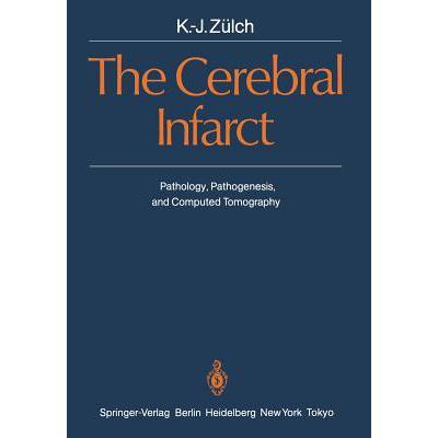 预订 the cerebral infarct : pathology, pathogenes.