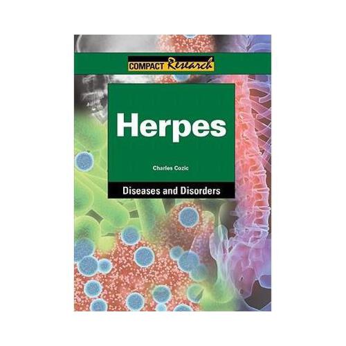 【预订】herpes