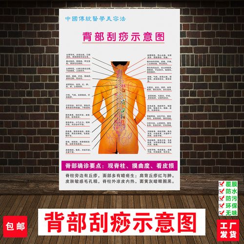 背部刮痧示意图养生馆美容人体穴位挂图中医宣传海报