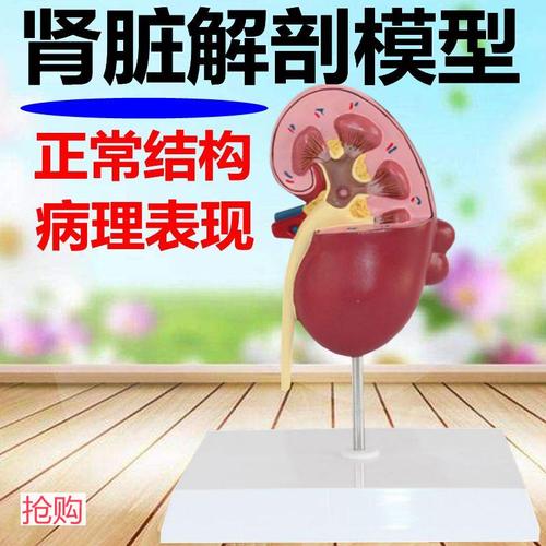 肾脏模型 人体肾结构健康病理泌尿外科医患沟通肾上腺临床医生用