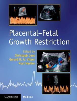 预订placental-fetal growth restriction