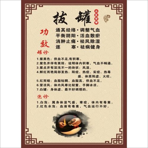 拔罐功效宣传画大挂图中医养生图片广告美容院装饰海报经络穴位图