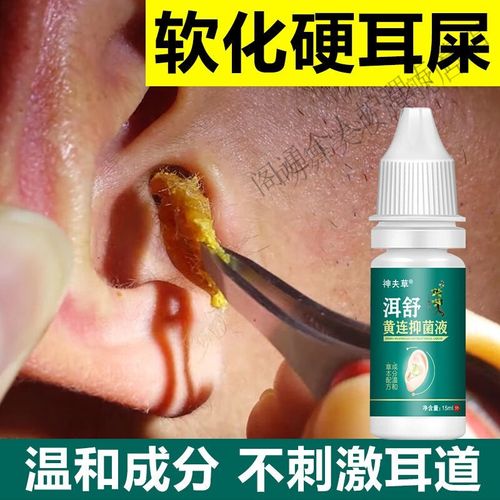 去除耳屎软化剂成人儿童滴耳液消11炎耳朵听不见耳鸣耳聋嗡嗡响 一