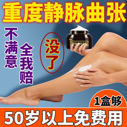 【曲张克星】静脉曲张膏蚯蚓腿部血管青筋红血丝老烂腿静脉曲张膏