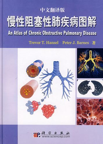 保证正版 慢性阻塞性肺疾病图解(翻译版)
