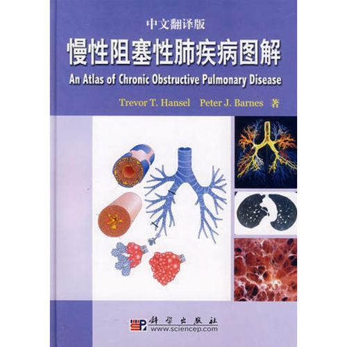 正版科学出版社 慢性阻塞性肺疾病图解(翻译版)  内科学 呼吸内科