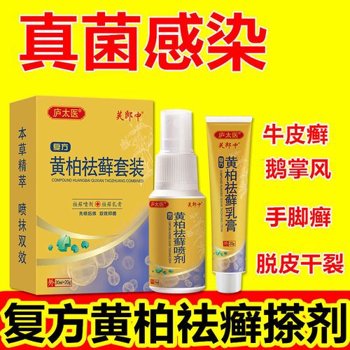 复方黄柏祛去癣搽剂牛皮癣银屑病湿疹毛囊焱真菌感染脱皮止痒特效