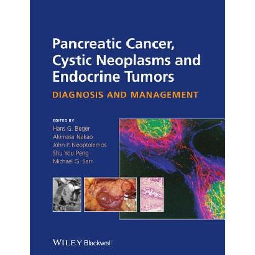 预订 pancreatic cancer, cystic neoplasms . [9780470673188]