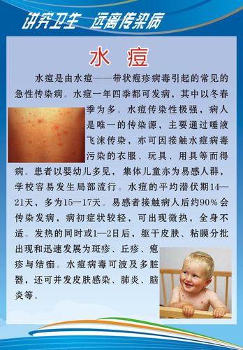 728海报印制展板写真喷绘贴纸627校健康知识3水痘