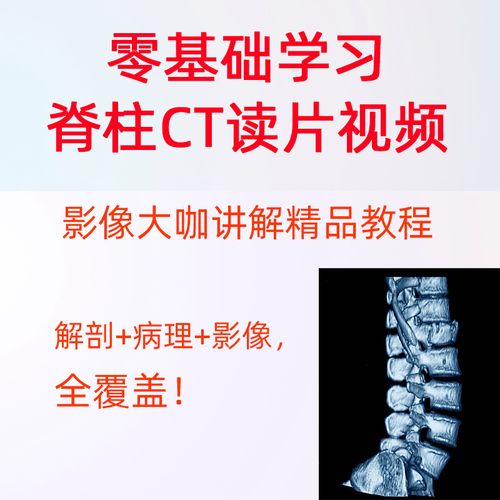 零基础学习脊柱ct读片指导脊柱ct影像解读学习视频课程骨科影像