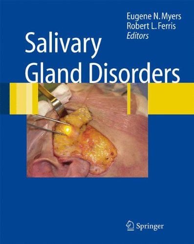 【预订】salivary gland disorders
