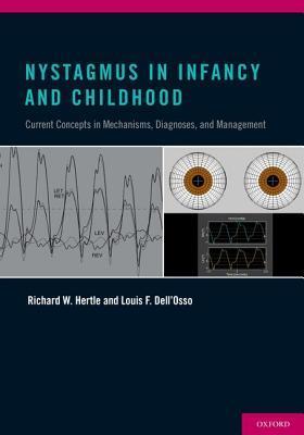 预订 nystagmus in infancy and childhood: current con