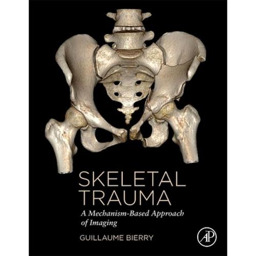 预订 skeletal trauma: a mechanism-based approach .