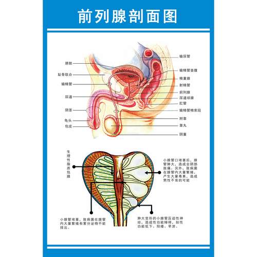 男性前列腺剖面图人体器官结构男性生殖泌尿解剖图挂图海报