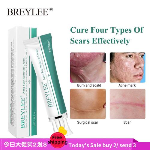 acne scar removal cream face repair skin whitening cream 30g