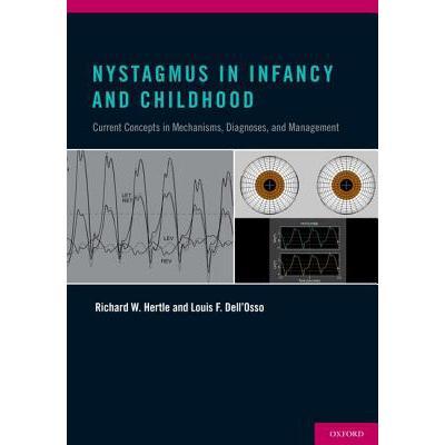 预订 nystagmus in infancy and childhood: current .