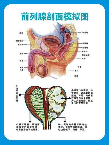 733海报印制展板写真喷绘324医院各科室挂图1前列腺剖面模拟图