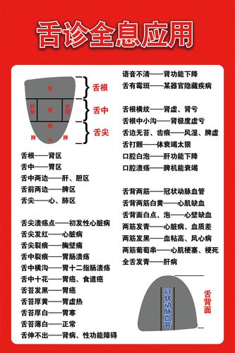 m768中医舌诊全息应用舌头对应症状1437海报印制展板写真喷绘挂图