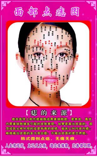 海报印制写真喷绘418设计展板素材45面部痣图定制图片贴纸