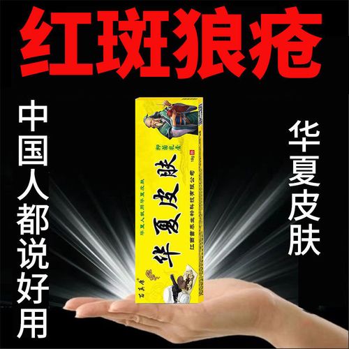 苗真康红斑狼疮皮肤瘙痒皮炎湿疹荨麻疹蚊虫叮咬手足脱皮牛皮癣膏