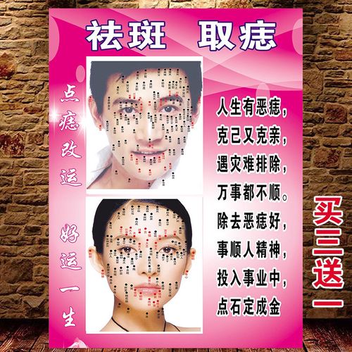男女面痣图海报 美容院养生会所祛痣点痣挂图 中医养生装饰画挂画