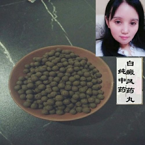 伟博中药材驱虫斑鸠菊丸白斑风药丸何首乌紫草苦参驱虫斑鸠菊脂