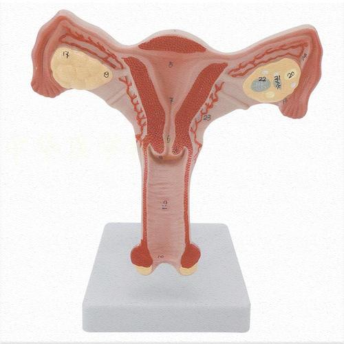 正常子宫 女性病理子宫模型 卵巢模型教学模具病理变化科普教具