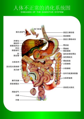 700海报印制展板写真喷绘1166人体不正常的消化系统图 非高清图