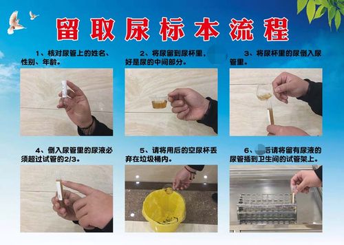 m769医院门诊留取尿标本流程图解示意墙贴纸展板写真海报印制1998