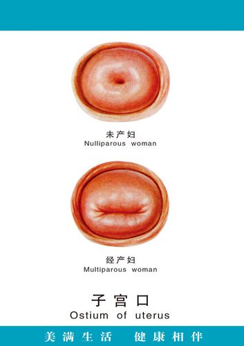 729海报印制展板写真喷绘贴纸286医院妇科人体科室女性子宫口图