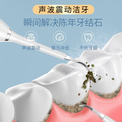 扁桃体结石去除工具超声波洗牙器电动牙刷去牙垢口臭神器牙齿