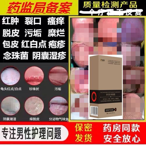 包皮龟头炎膏阴囊潮湿痒冠状沟珍珠粒红点大腿内侧长癣阴部湿疹痒